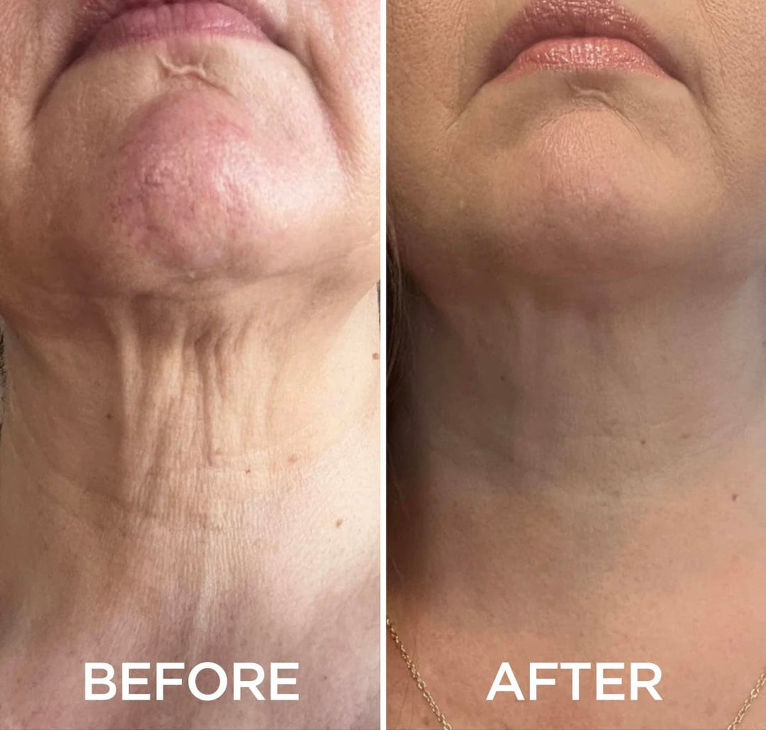 FemGlide Neck Tighten & Firming Cream